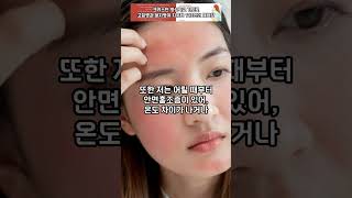 가슴 통증과 안면홍조증을 치유해주신 하나님_기도로 고질병과 불치병이 치유된 113人의 체험담 中 #shorts