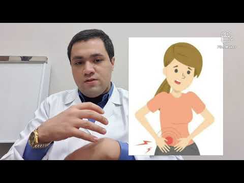  التهاب الزائدة الدودية