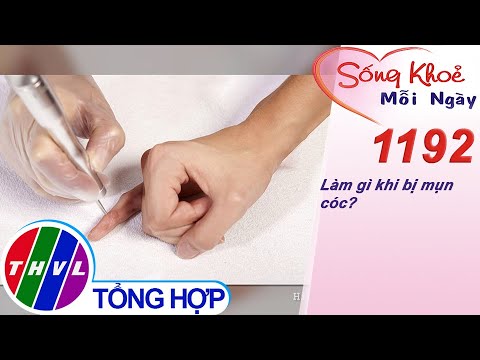 Mụn Cóc Sinh Dục Và Cách Chữa Trị - Làm gì khi bị mụn cóc? ​| Sống khỏe mỗi ngày - Kỳ 1192