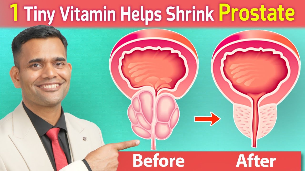 Vitamin Helps To Shrink Prostate