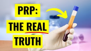 What Science ACTUALLY Says About PRP Injections: The InDepth Truth You Need to Know
