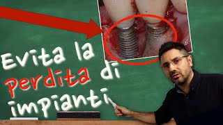 Le cause della Perimplantite: Quello che ogni dentista dovrebbe sapere