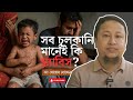 সব চুলকানি কিন্তু স্ক্যবিস নয় | Skin Point | Dr. Shoeb Hossain