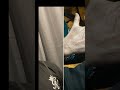 SỐC! 😱 Người đàn ông da xanh như Avatar khiến bệnh viện HỐT HOẢNG: Thủ phạm KHÔNG AI NGỜ! 😲