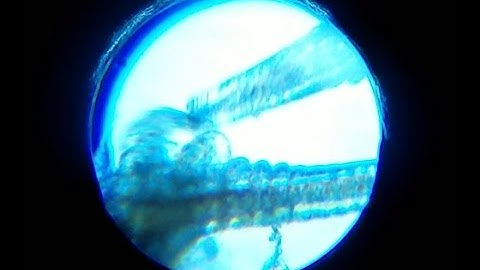 Waltz of the Brine Shrimp (Brine Shrimp under a microscope)