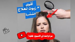 افضل علاج قشرة الشعر نهائيا   | اقوى 3 زيوت تمنع وتحارب قشرة الشعر بكل انواعها