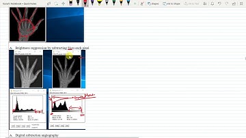 Lecture 10: Image Enhancement in Spatial Domain (Part- II)