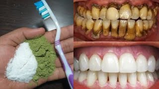 आपके गंदे पीले दाँतो को 2 मिनट में मोतियों जैसा सफ़ेद और चमकदार बना देगा | magical teeth whitening