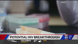 Scientists Discover Potential HIV Breakthrough Scientists Discover Potential HIV Breakthrough