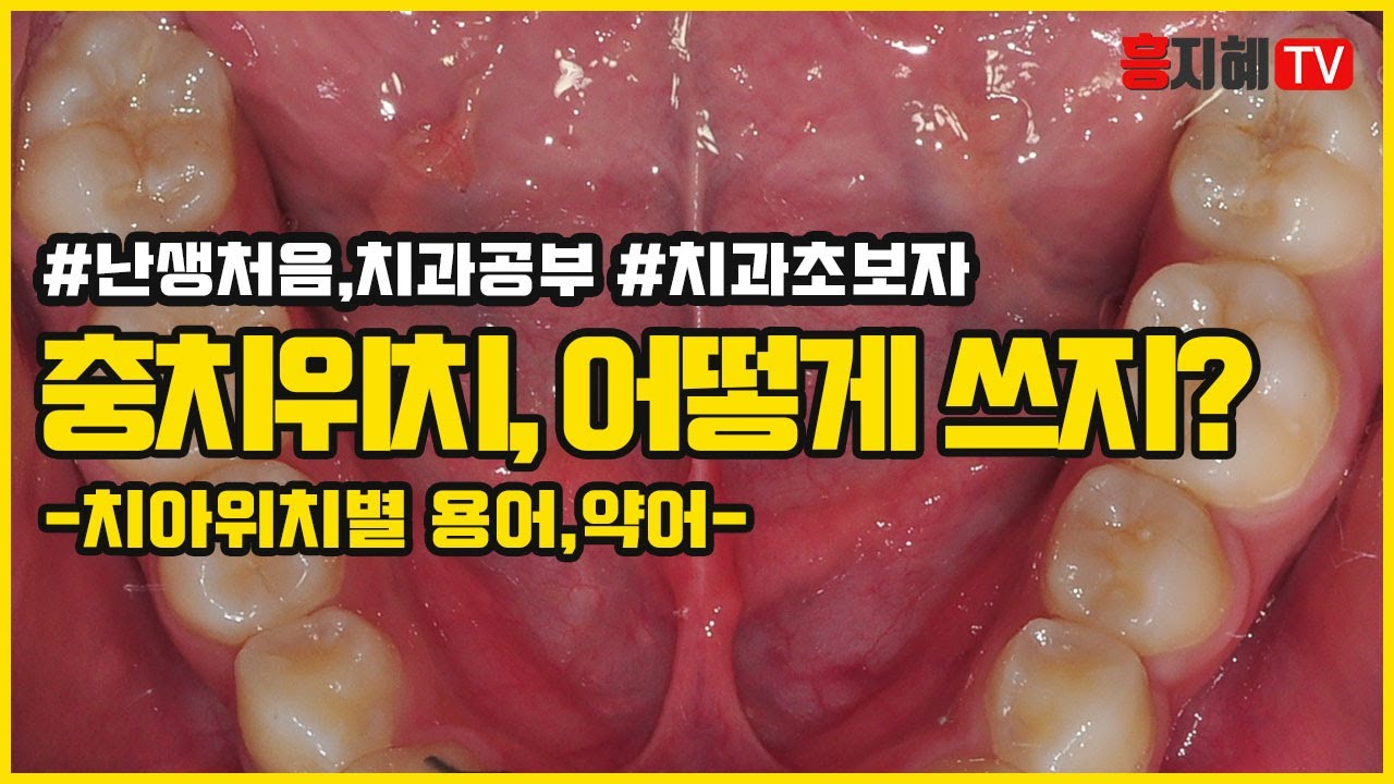 [난생처음,치과공부] #4.치아 위치별 치과용어,약어 구강내 용어