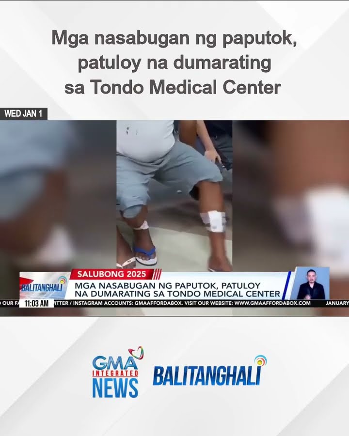 Mga nasabugan ng paputok, patuloy na dumarating sa Tondo Medical Center | Balitanghali