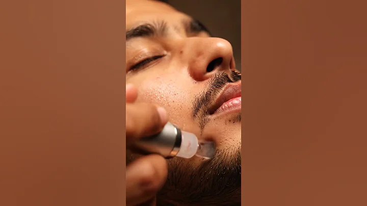 "Most Satisfying Blackhead Suction Ever! (Realistic ASMR)"