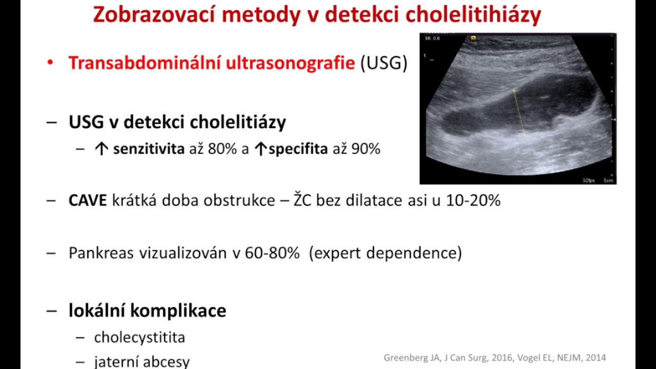 Indikace k endoskopické terapii akutní biliární pankreatitidy