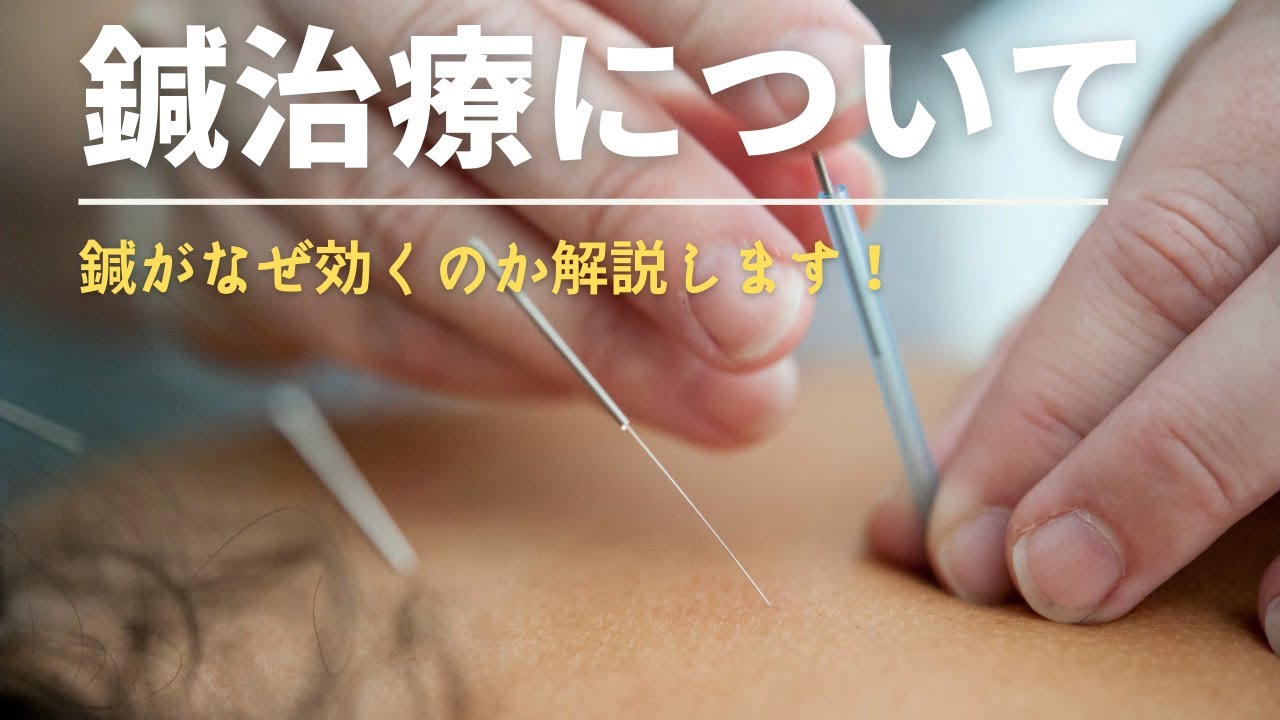 週2回の鍼治療は可能ですか？