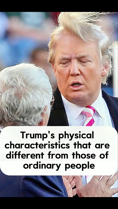 Trumps physical characteristics that are different from those of ordinarily people
