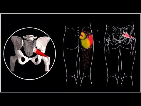 СИНДРОМ ГРУШЕВИДНОЙ МЫШЦЫ И ЗАЩЕМЛЕНИЕ СЕДАЛИЩНОГО НЕРВА ⭐ SLAVYOGA