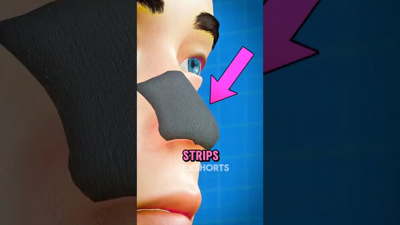 If You Ever Thought Pore Strips Were Safe, Think Again 🤔