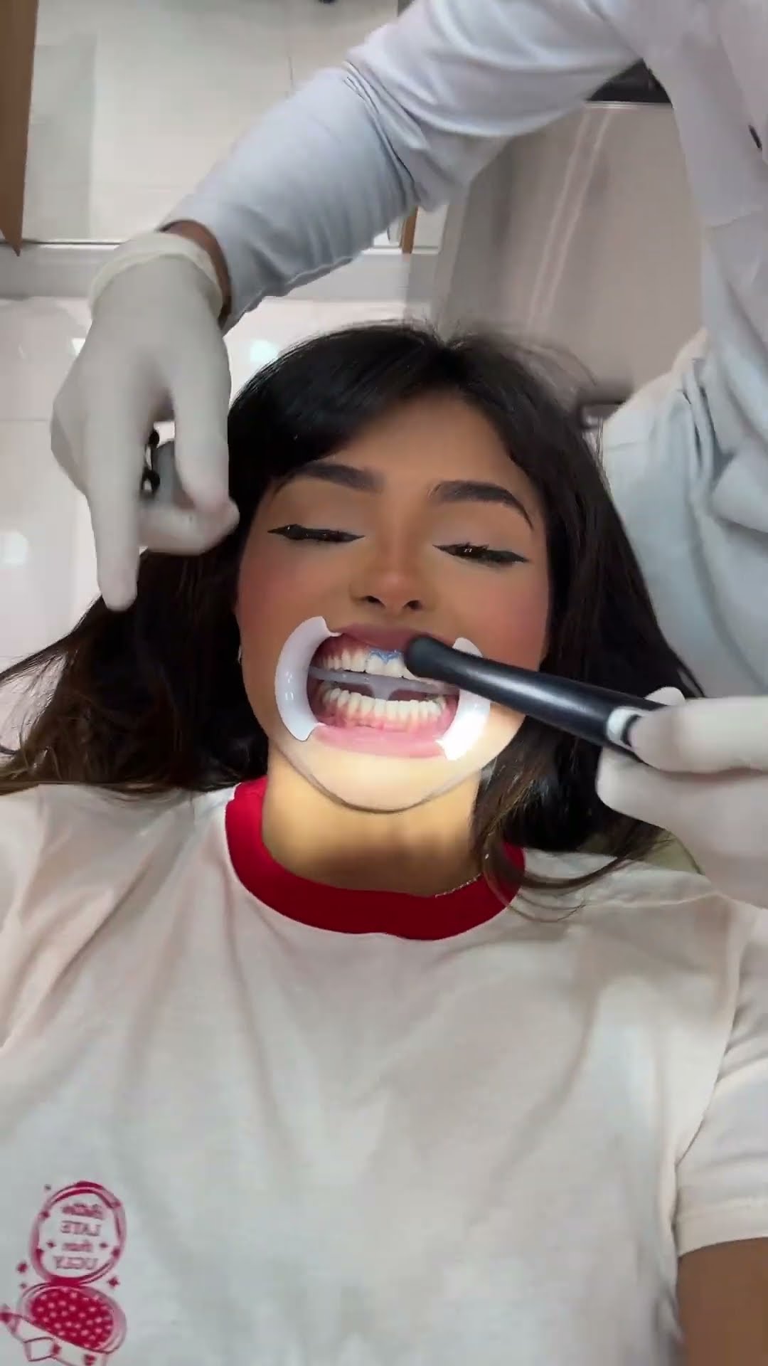 TIKTAKA NO DENTISTA HAHAHAHAH