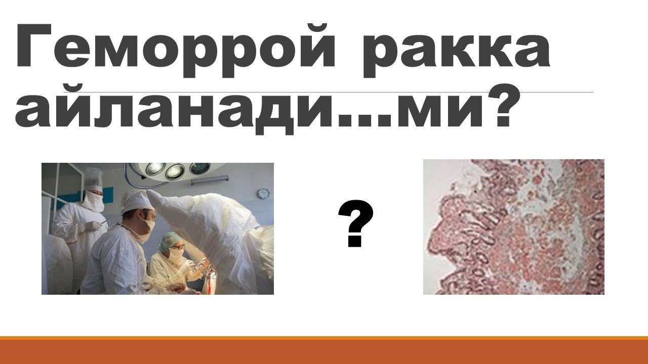 геморрой ракка айланадими?