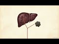 Interventional Radiology Guide to Hepatic and Biliary Procedures