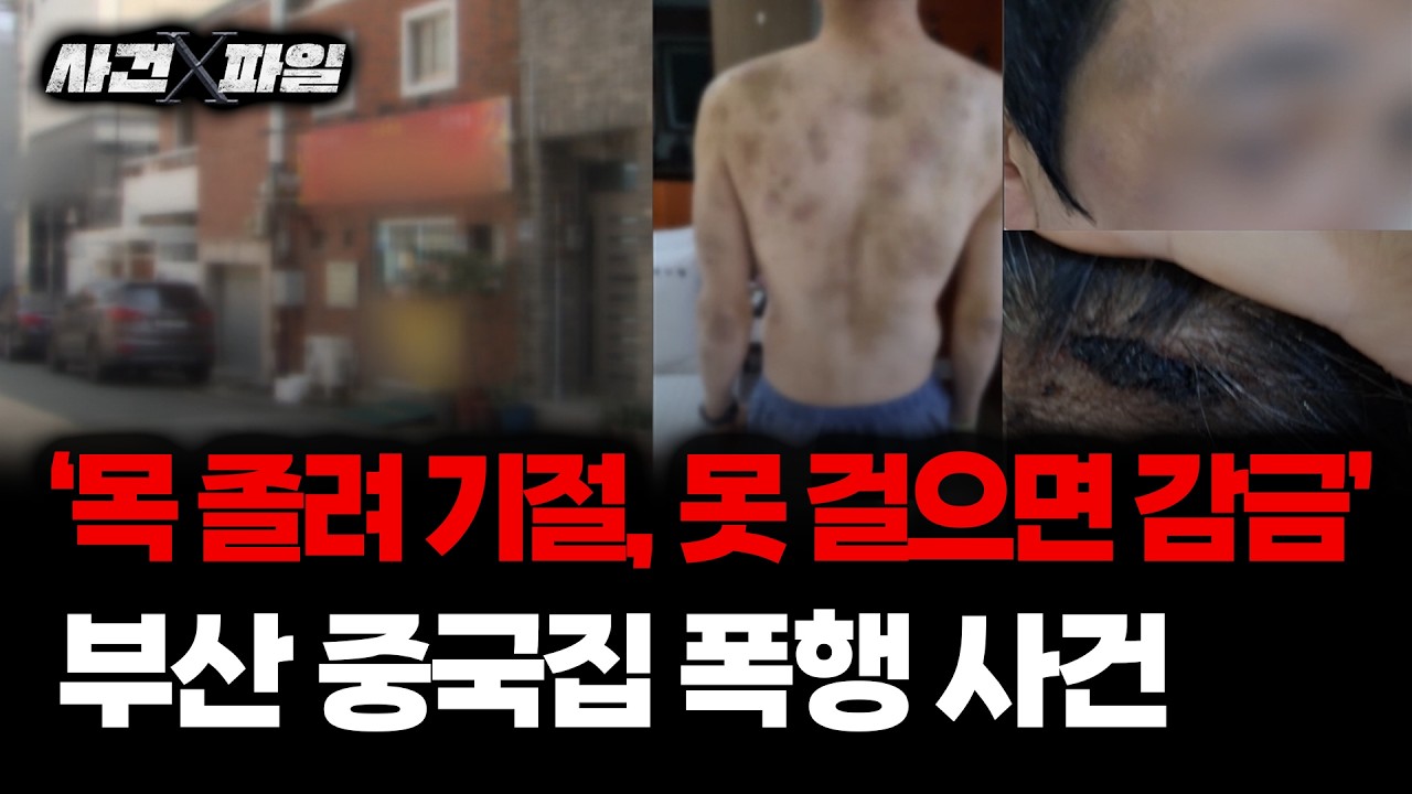보이는 라디오 이미지