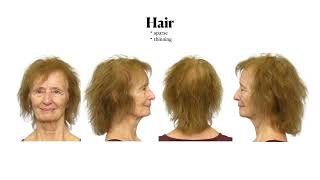 78 And Looking Great - A Makeoverguy Power Of Beauty Transformation