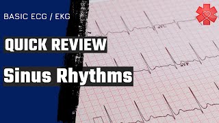 Sinus Rhythms: What You Need to Know