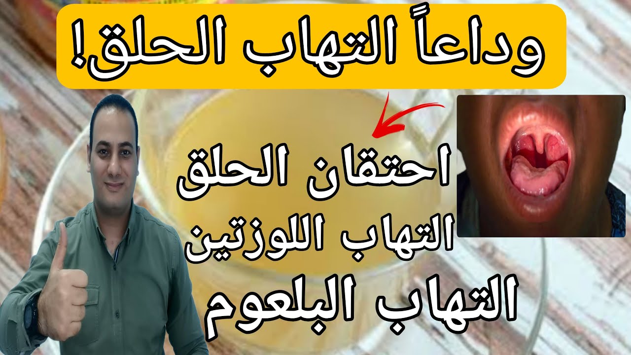 اسرع واقوي وصفه طبيعيه تعالج تشفي التهاب الحلق ومجربه بدون ادوية | علاج احتقان الحلق