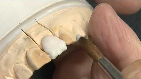 MDT. Hitoshi Aoshima using Cerabien ZR (CZR) for Build-up Technique. Part 4.