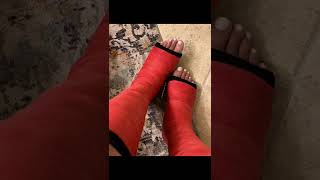 Double Short Leg Cast Red
