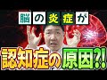 脳の炎症を抑えて記憶力改善！脳を若返らせる抗炎症習慣