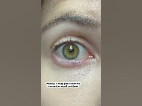 У меня родинка в глазу))) - YouTube