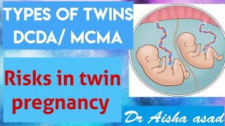 Types of twins- DCDA/MCDA/MCMA- Risk in twin pregnancy- Urdu/Hindi