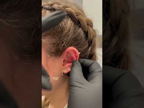 Video: Gør industriel piercing ondt?