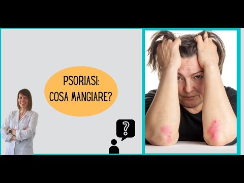 Video: Come Seguire la Dieta Giusta per la Psoriasi: 15 Passaggi