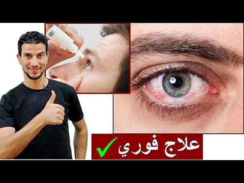 فيديو: هل تساعد قطرات العين في علاج احمرار البثور؟