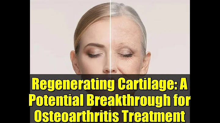Regenerating Cartilage: A Potential Breakthrough for Osteoarthritis Treatment