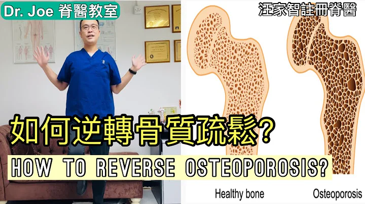 如何逆轉骨質疏鬆？ Dr Joe 教大家兩種方: 運動及營養[Eng Subtitles] How to Reverse Osteoporosis in 2 Steps. - 天天要聞