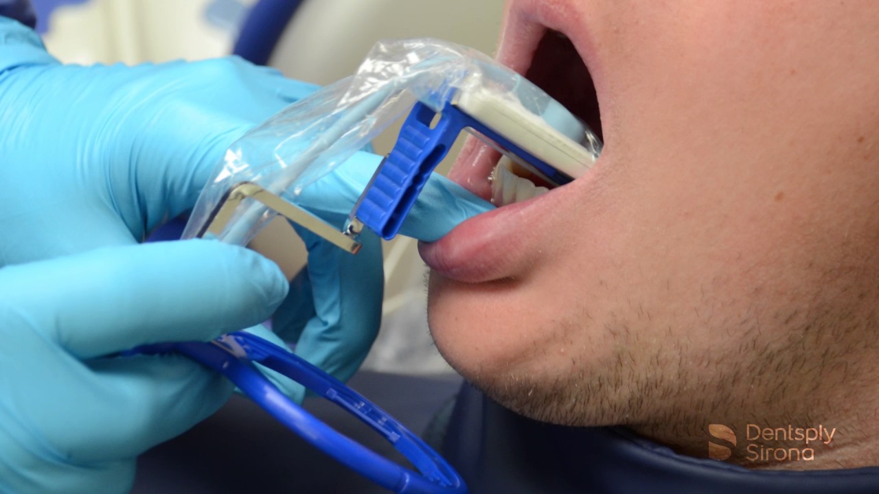 Setting Up Rinn Instruments RINN XCP Short Arm Anterior Placement | Dentsply Sirona - YouTube