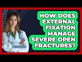 How Does External Fixation Manage Severe Open Fractures? - Orthopedic Support Network
