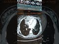 CT VS MRI ? #healthtips #doorstepdx #Radiology #DiagnosticTests #ManaHealthCheck