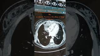 CT VS MRI ? #healthtips #doorstepdx #Radiology #DiagnosticTests #ManaHealthCheck