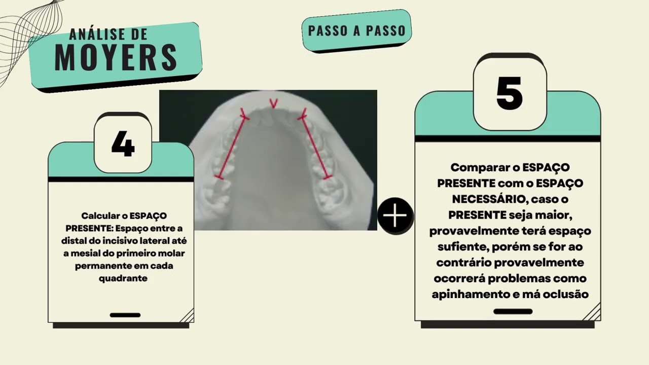 Análise de Moyers - Ortodontia