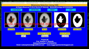 Skin Cancer Detection Using Python OpenCV Project Source Code | Melanoma Lesion Detection Using CNN