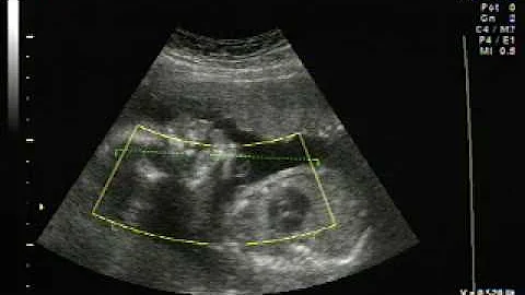 Brigitth Cedeno 6 meses ana cedeo