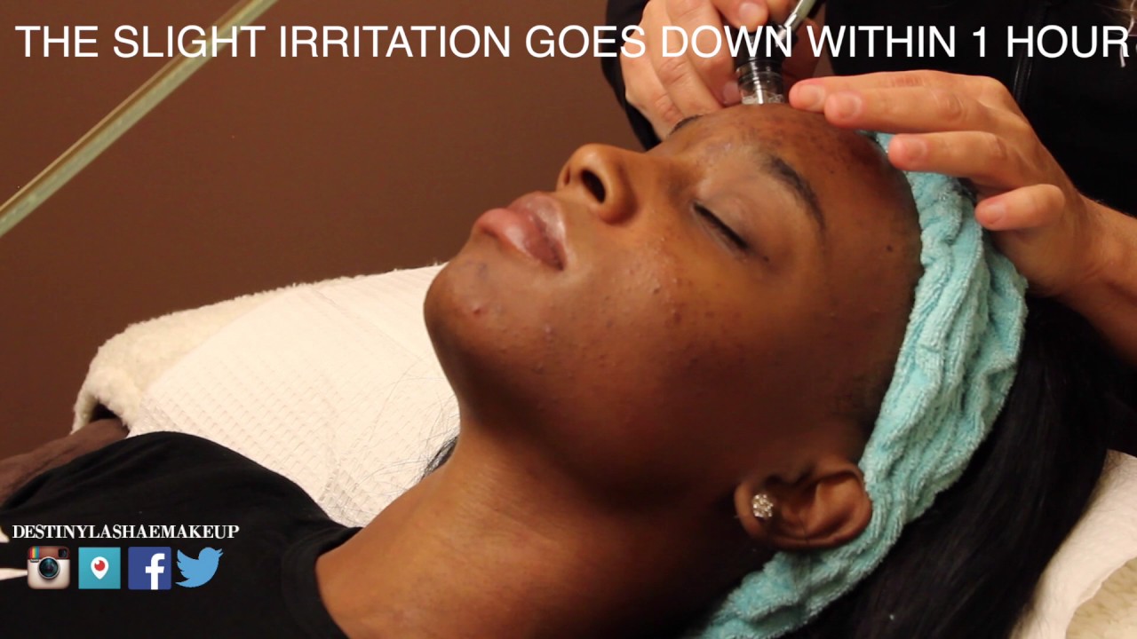 SMOOTHER, BRIGHTER SKIN OVERNIGHT!? - My Silk Peel Experience