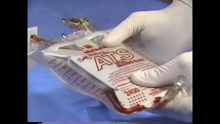 Managing Chest Tube Drainage AUTOTRANSFUSION