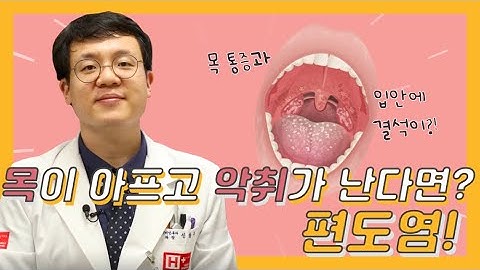 목이 아프고 악취가 난다면? 편도염! 에이치플러스 양지병원 이비인후과