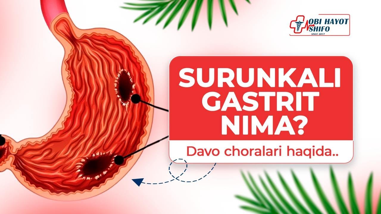 Surunkali Gastrit nima ? Davo choralari haqida..! | Obi Hayot Shifo | Fergana 2024