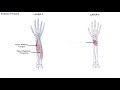 Anatomy of the Forearm - Muscles and Tendons - Lesson 1